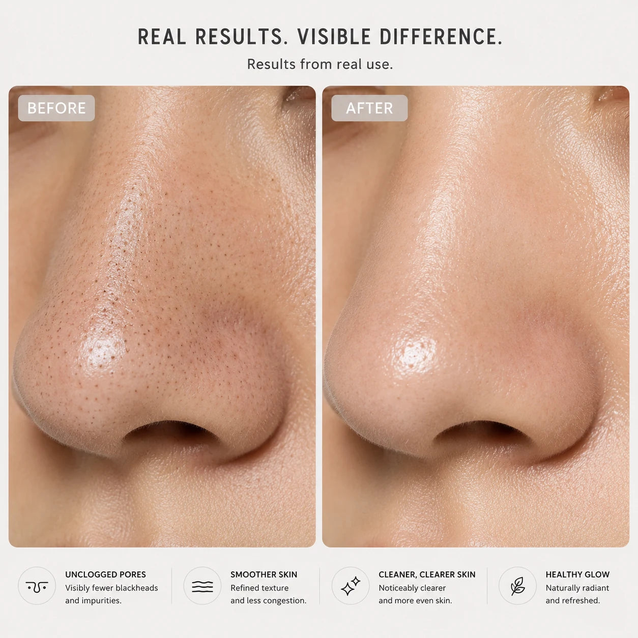 Before and after pore cleansing results showing reduced blackheads and clearer-looking skin
