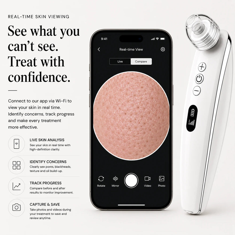 PoreSkn Pro+ pore extraction device with real-time skin viewing app for pores and blackheads