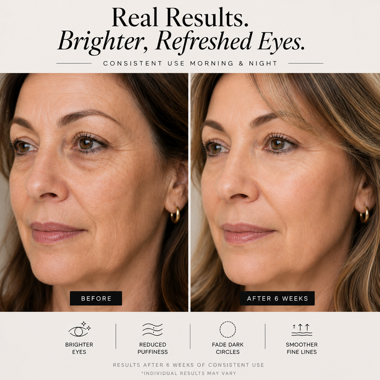 Before and after comparison showing visible improvement in under-eye puffiness, fine lines and skin brightness after 6 weeks of using the Sheskn Eye Therapy LED and EMS device.