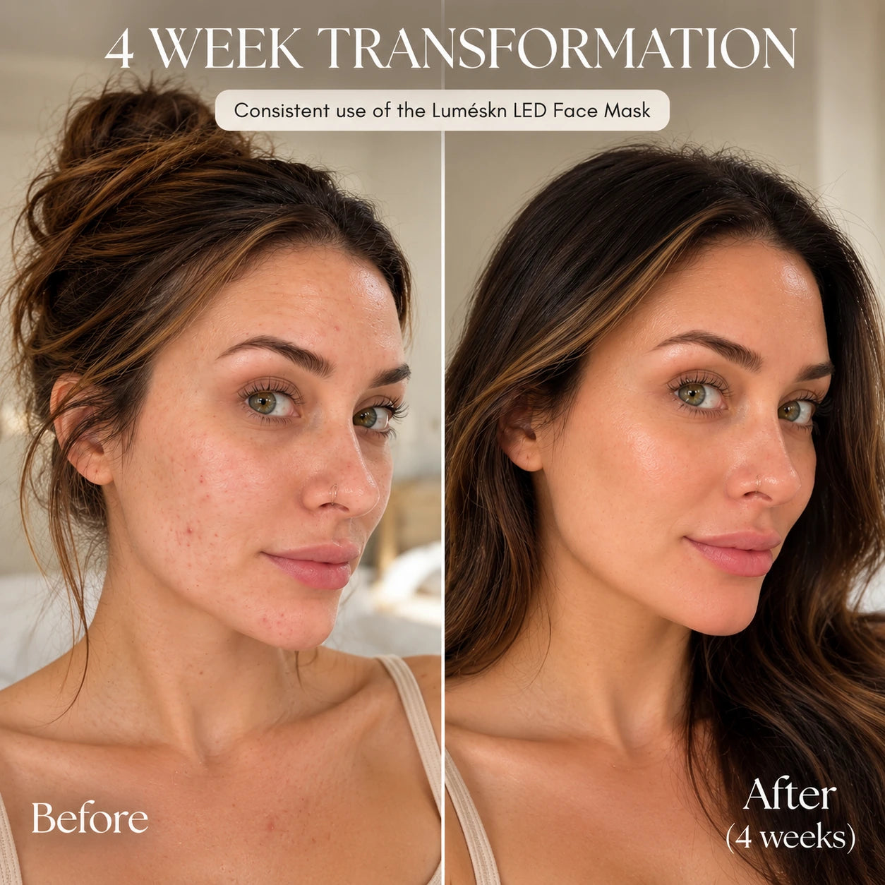 Luméskn LED Face Mask before and after results following four weeks of consistent use