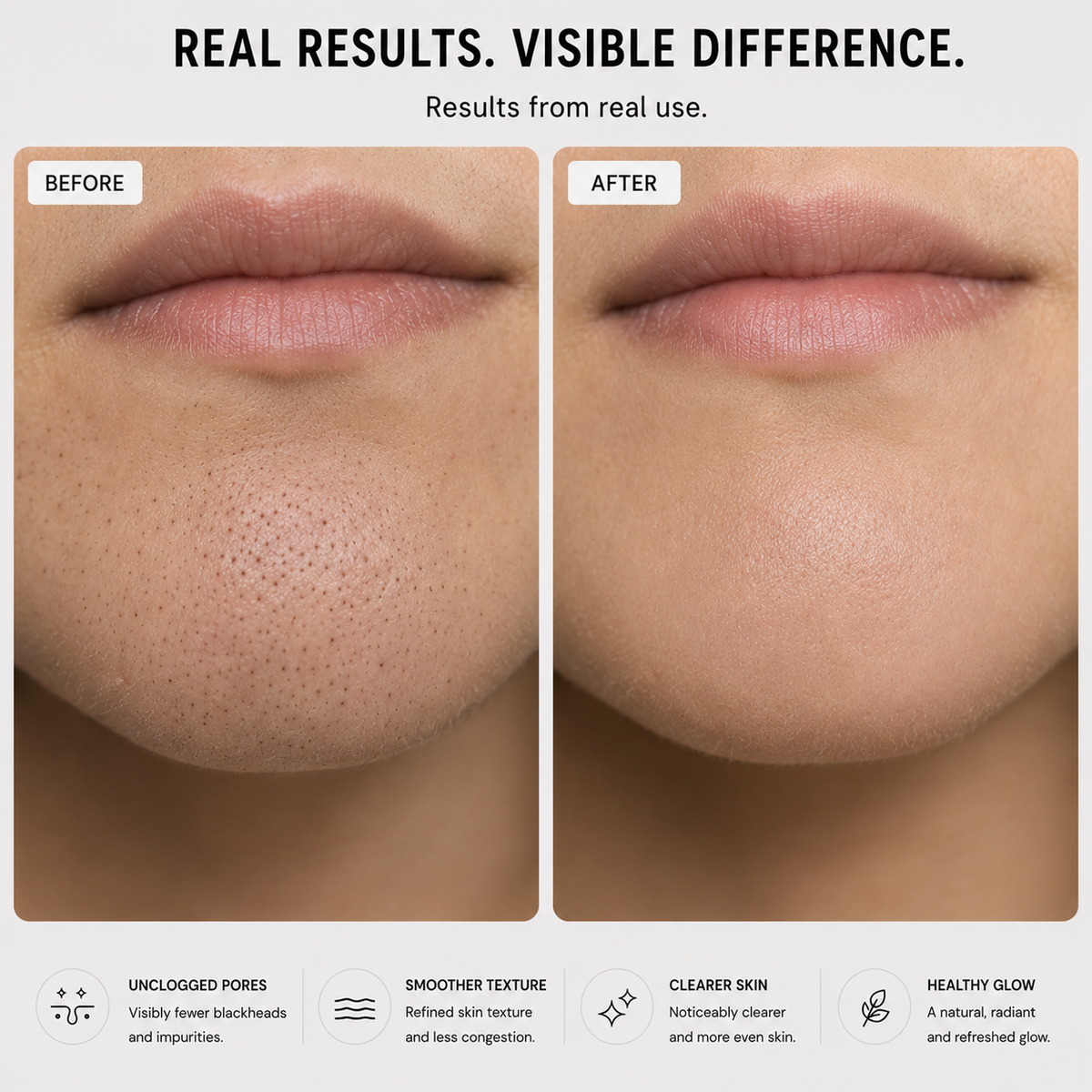 Before and after comparison of skin texture on lips with text 'Real Results. Visible Difference.'