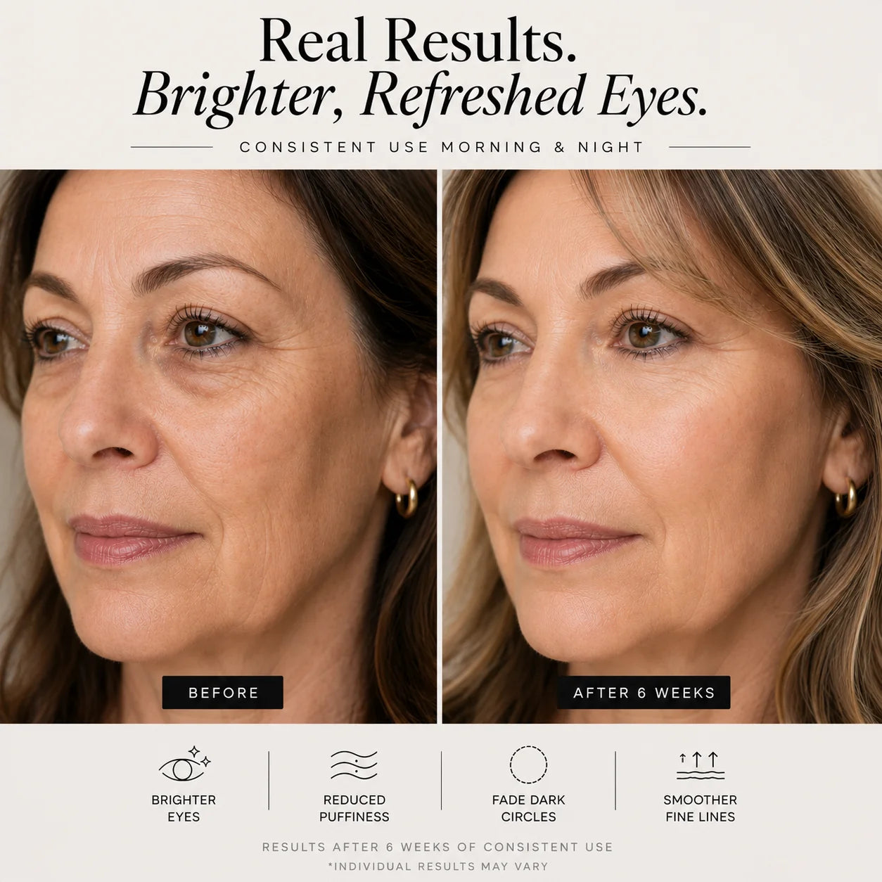 Sheskn Eye Therapy before and after 6 weeks of consistent LED and EMS under eye use
