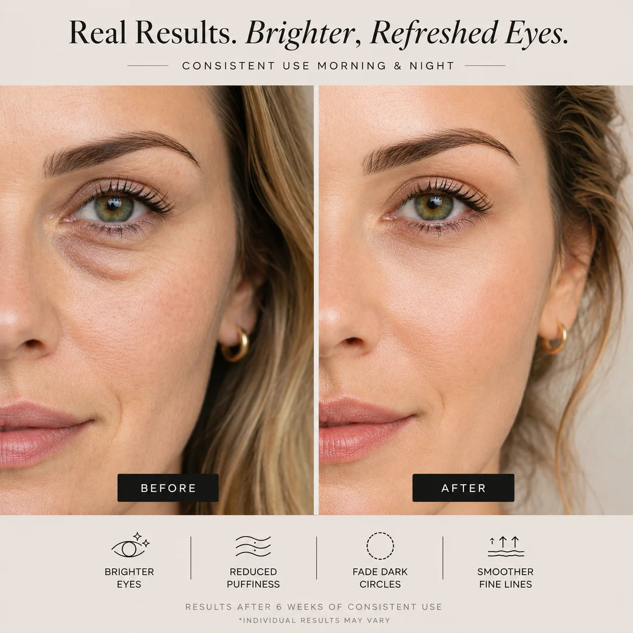 Sheskn Eye Therapy before and after results showing brighter under eyes and reduced puffiness