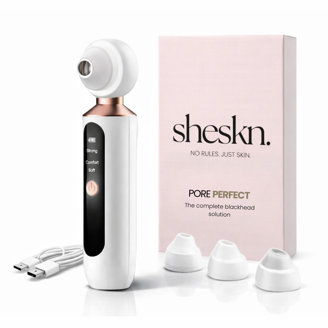 Sheskn Pore Perfect blackhead remover kit including pore vacuum device with rose gold detail, three interchangeable suction tips, charging cable and product box on a clean white background