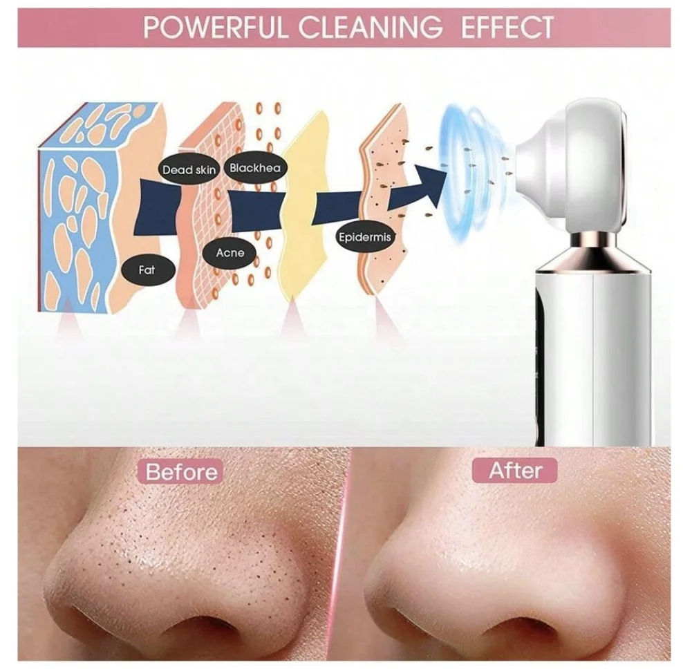 Sheskn Pore Perfect beauty tool that deeply cleanses and refines pores